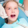 Răng em bị sậm màu, em nên tẩy trắng răng hay làm răng sứ?